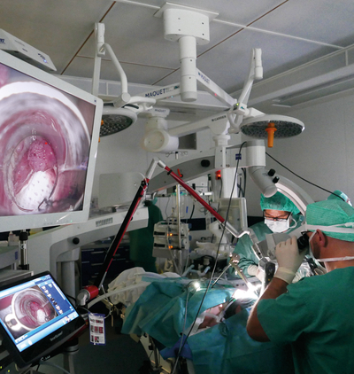 Bild Siloah St. Trudpert Klinikum, HNO, OP-Szenario, Ärzte operieren mit dem CO2-Laser